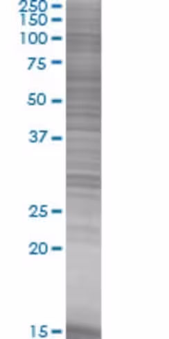 Pin4 293t cell transient overexpres sion lysate (denatured) 100 µl