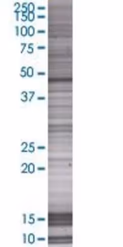 Pip5k2a 293t cell transient overexp ression lysate (denatured) 100 µl