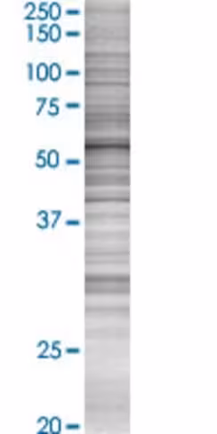 Pkm2 293t cell transient overexpres sion lysate (denatured) 100 µl