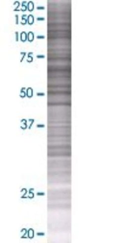Plat 293t cell transient overexpres sion lysate (denatured) 100 µl