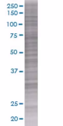 Plaur 293t cell transient overexpre ssion lysate(denatured) 100 µl