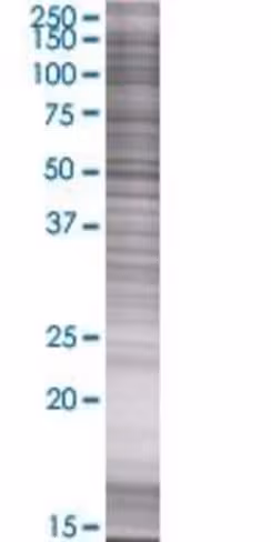 Plcg2 293t cell transient overexpre ssion lysate (denatured) 100 µl