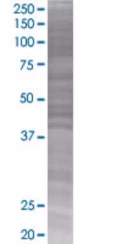Plcg2 293t cell transient overexpre ssion lysate (denatured) 100 µl