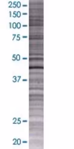 Plek 293t cell transient overexpres sion lysate (denatured) 100 µl