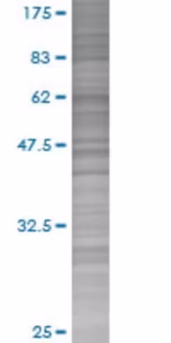 Plp1 293t cell transient overexpres sion lysate (denatured) 100 µl