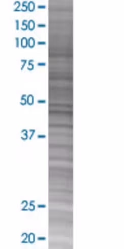 Plrg1 293t cell transient overexpre ssion lysate (denatured) 100 µl
