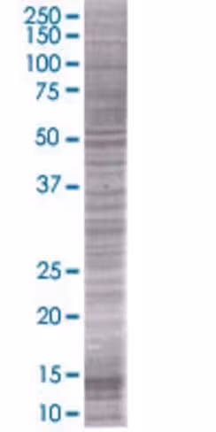 Pmaip1 293t cell transient overexpr ession lysate(denatured) 100 µl