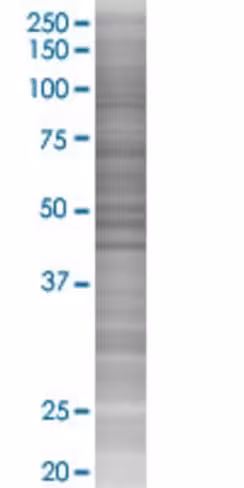 Pms2 293t cell transient overexpres sion lysate (denatured) 100 µl