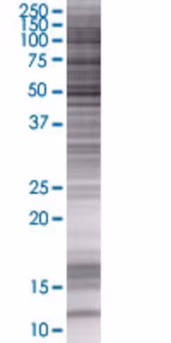 Pnlip 293t cell transient overexpre ssion lysate (denatured) 100 µl