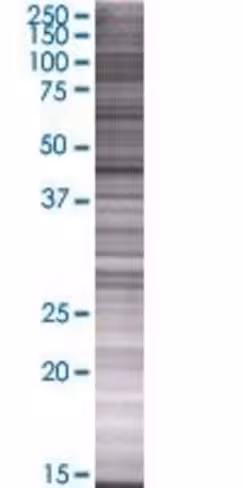Pnliprp1 293t cell transient overex pression lysate(denatured) 100 µl