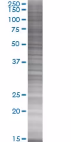 Pnn 293t cell transient overexpress ion lysate (denatured) 100 µl