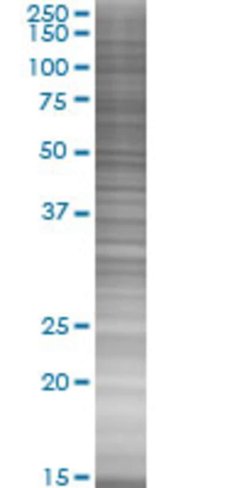 Pnn 293t cell transient overexpress ion lysate (denatured) 100 µl