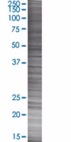 Pold2 293t cell transient overexpre ssion lysate (denatured) 100 µl