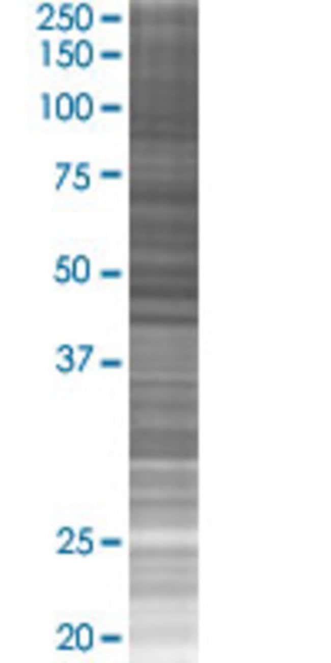 Polr2l 293t cell transient overexpr ession lysate (denatured) 100 µl