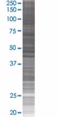 Polr2l 293t cell transient overexpr ession lysate (denatured) 100 µl