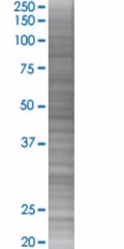 Pomc 293t cell transient overexpres sion lysate (denatured) 100 µl