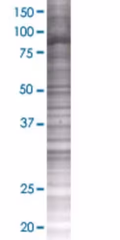 Pou2f1 293t cell transient overexpr ession lysate (denatured) 100 µl