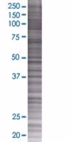 Pou3f4 293t cell transient overexpr ession lysate (denatured) 100 µl