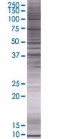 Pou6f1 293t cell transient overexpr ession lysate (denatured) 100 µl