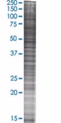 Ppara 293t cell transient overexpre ssion lysate (denatured) 100 µl