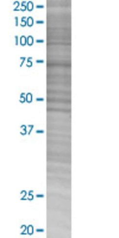 Ppef1 293t cell transient overexpre ssion lysate (denatured) 100 µl