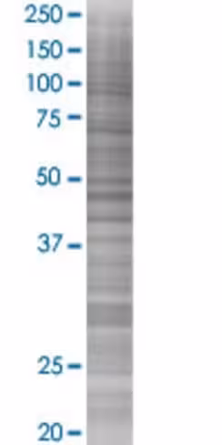 Ppid 293t cell transient overexpres sion lysate (denatured) 100 µl
