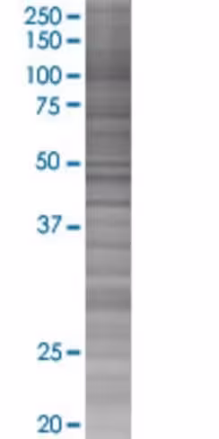 Ppp1r2 293t cell transient overexpr ession lysate (denatured) 100 µl