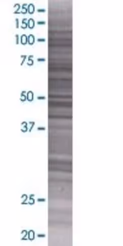 Ppp1r7 293t cell transient overexpr ession lysate (denatured) 100 µl