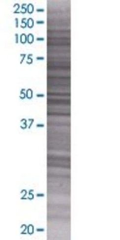 Ppp1r7 293t cell transient overexpr ession lysate (denatured) 100 µl