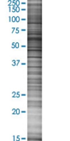 Ppp2r1a 293t cell transient overexp ression lysate (denatured) 100 µl