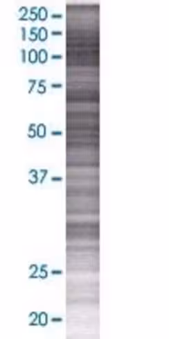 Ppp2r5a 293t cell transient overexp ression lysate (denatured) 100 µl