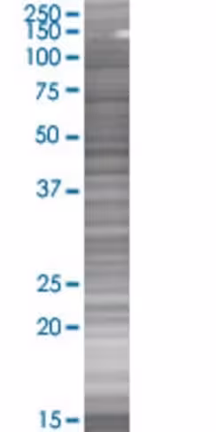 Ppp3r1 293t cell transient overexpr ession lysate (denatured) 100 µl