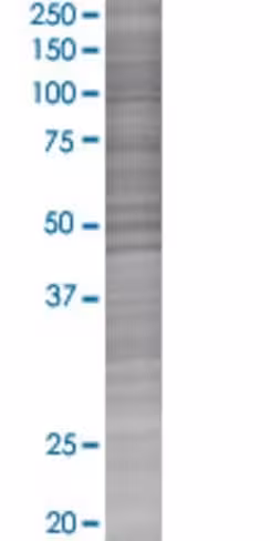 Ppp3r2 293t cell transient overexpr ession lysate (denatured) 100 µl