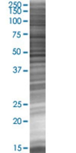Ppp6c 293t cell transient overexpre ssion lysate (denatured) 100 µl