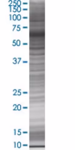 Ppy (1-96) 293t cell transient over expression lysate(denatured) 100 µl