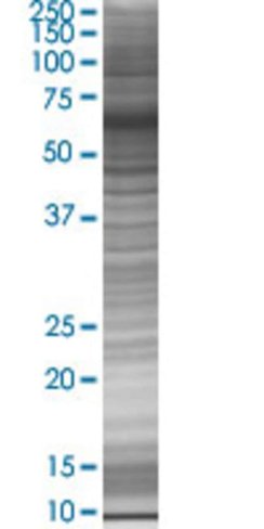 Ppy (1-96) 293t cell transient over expression lysate(denatured) 100 µl