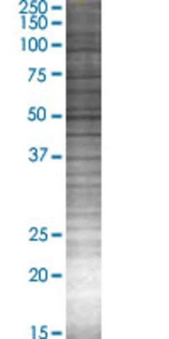 Ppyr1 293t cell transient overexpre ssion lysate (denatured) 100 µl