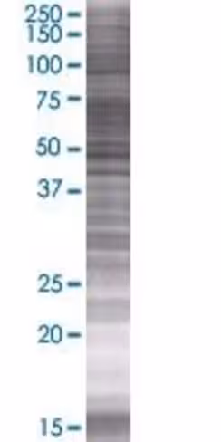 Prcp 293t cell transient overexpres sion lysate (denatured) 100 µl
