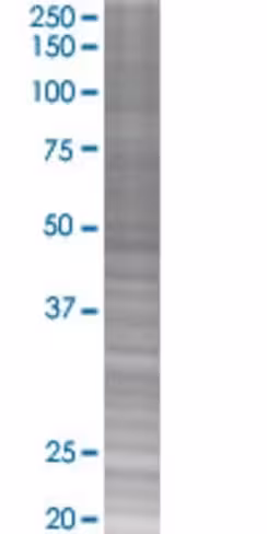 Prcp 293t cell transient overexpres sion lysate (denatured) 100 µl