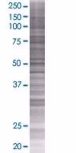 Prep 293t cell transient overexpres sion lysate (denatured) 100 µl