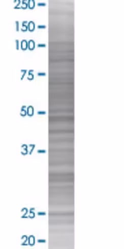 Prf1 293t cell transient overexpres sion lysate (denatured) 100 µl