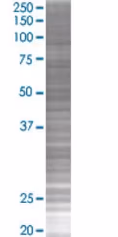 Prkaa2 293t cell transient overexpr ession lysate (denatured) 100 µl