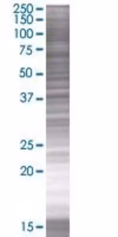 Prkacg 293t cell transient overexpr ession lysate (denatured) 100 µl