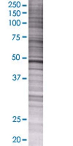 Prkar2a 293t cell transient overexp ression lysate (denatured) 100 µl