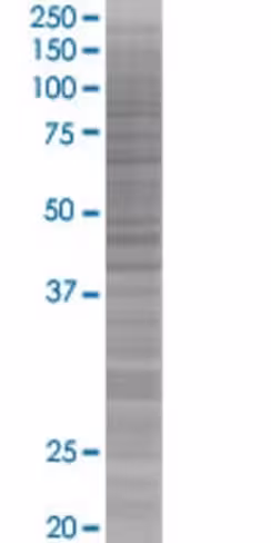 Prkcb1 293t cell transient overexpr ession lysate (denatured) 100 µl