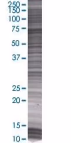 Prkcz 293t cell transient overexpre ssion lysate (denatured) 100 µl