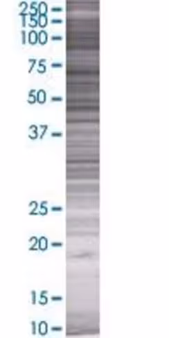 Prkg1 293t cell transient overexpre ssion lysate (denatured) 100 µl