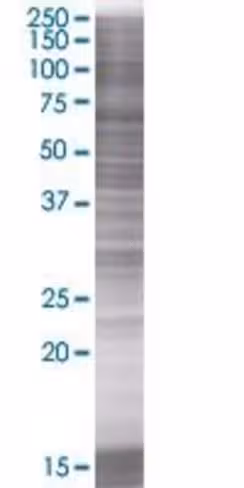 Prkx 293t cell transient overexpres sion lysate (denatured) 100 µl