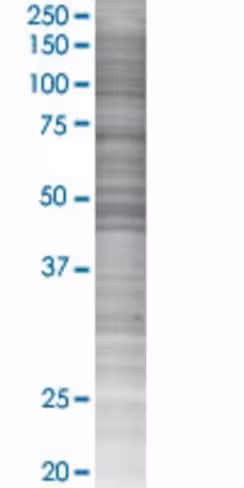 Prkx 293t cell transient overexpres sion lysate (denatured) 100 µl