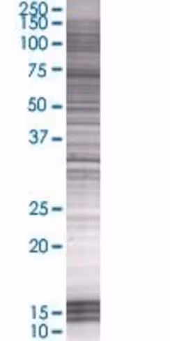 Prky 293t cell transient overexpres sion lysate (denatured) 100 µl